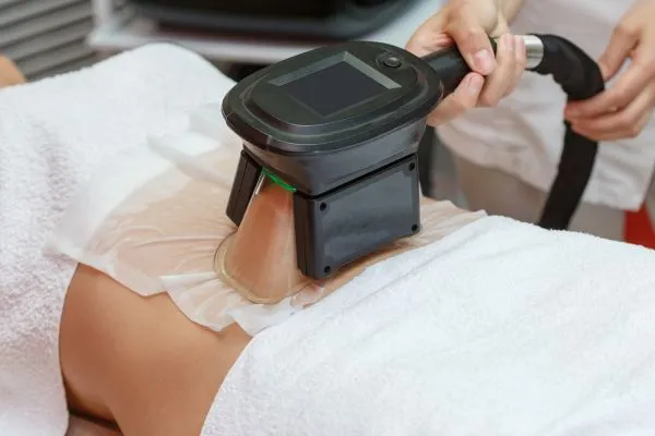 Image of person having fat freezing treatment to help weight gain Iver
