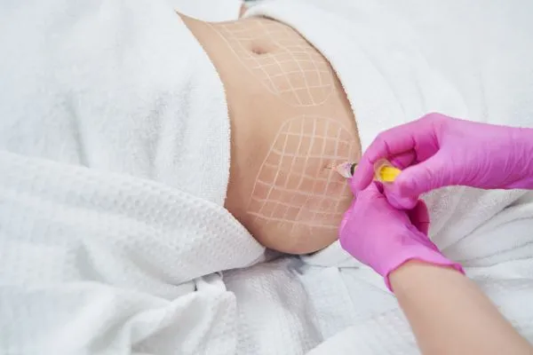 image of fat dissolving injections on love handles to help combat weight gain Iver