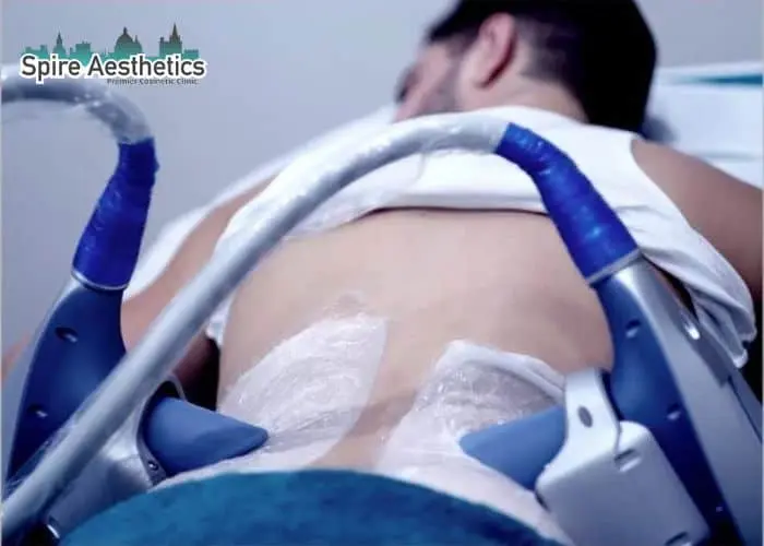 Man having fat freezing treatment done on love handles before a competitions Iver to create a sculpted look.