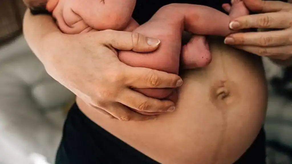 Why Is My Stomach Still Big After Pregnancy Iver?